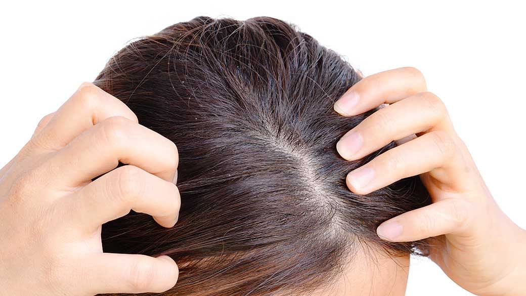 7 Best Shampoos For Dandruff & Itchy Scalp Under $25 - The Singapore  Women's Weekly