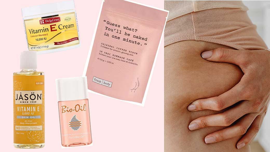 5 Best Stretch Mark Creams & Advice We Got From The Internet