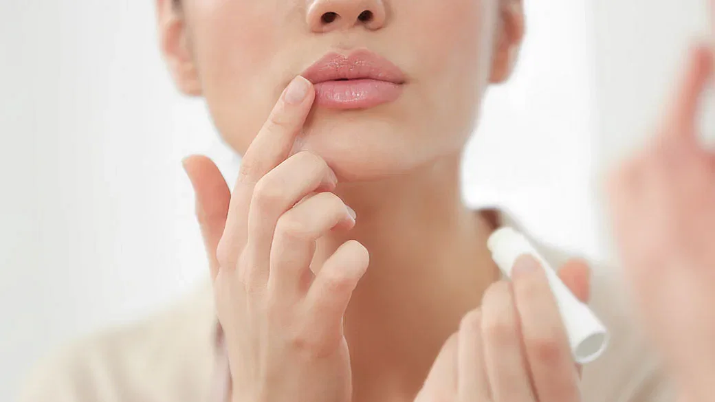 Your Dry, Cracked And Itchy Lips Could Be Due To Cheilitis