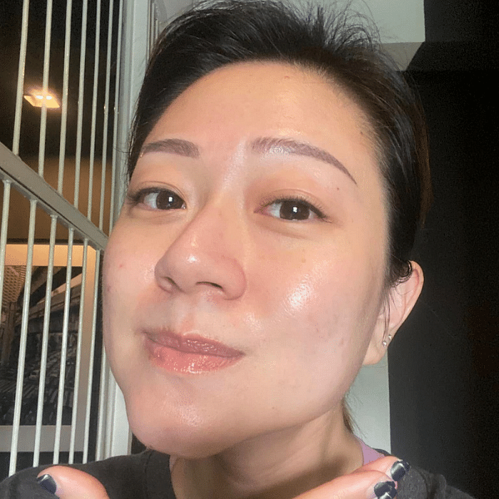 The Power Of Probiotics Why Netizens Cant Stop Raving About This Face